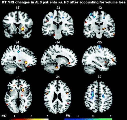 Fig 3.