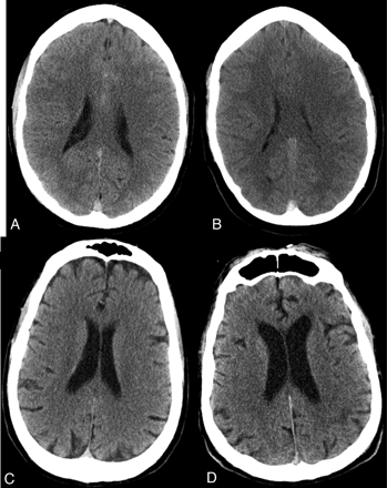 Fig 3.