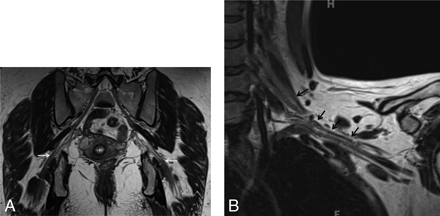 Fig 2.