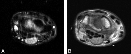 Fig 7.