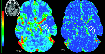 Fig 1.