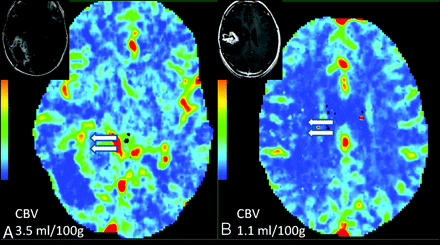 Fig 4.