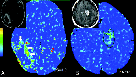 Fig 5.