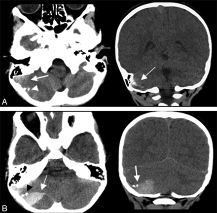 Fig 2.