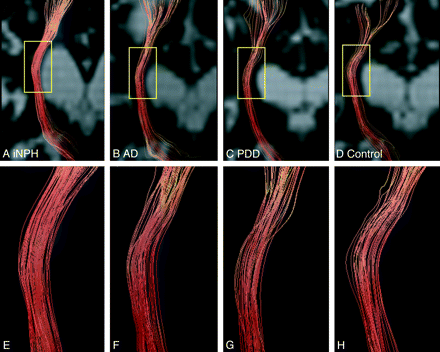 Fig 3.