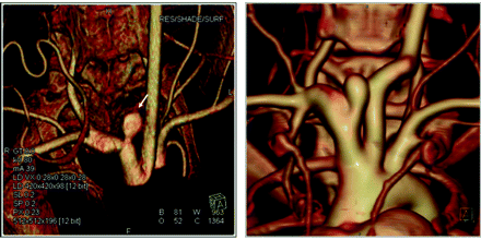 Fig 7.