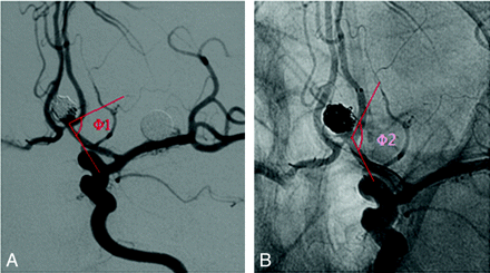 Fig 2.