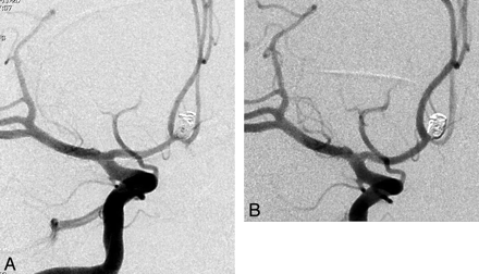 Fig 3.