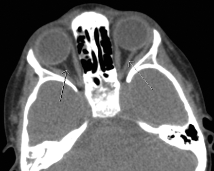 Fig 2.