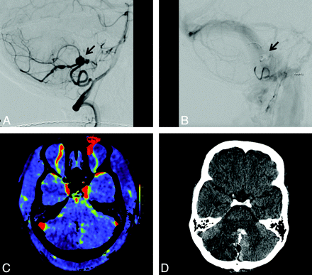 Fig 2.