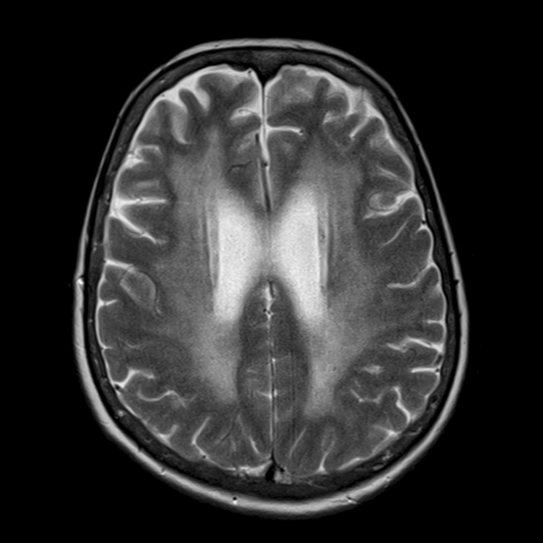 Imaging Approaches for Dementia | American Journal of