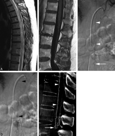 Fig 2.