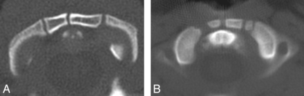 Fig 3.