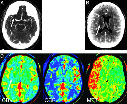 Fig 3.