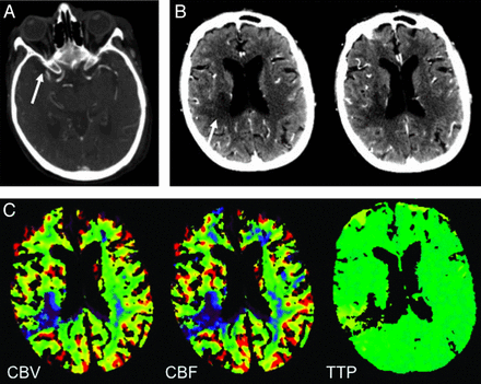 Fig 4.