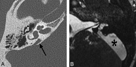 Fig 7.