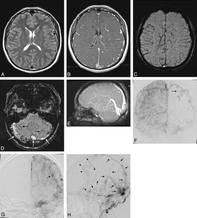 Fig 3.