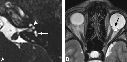 Fig 2.