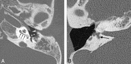 Fig 6.