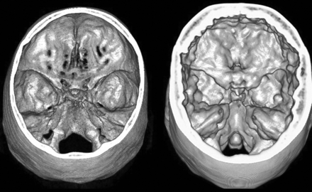 Fig 1.