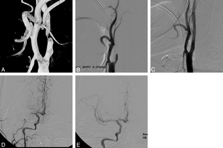 Fig 2.