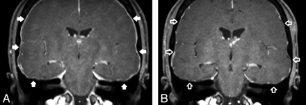 Fig 3.