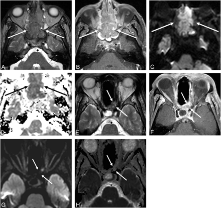 Fig 5.