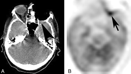 Fig 6.