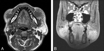 Fig 3.