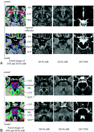 Fig 2.