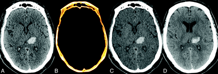 Fig 2.