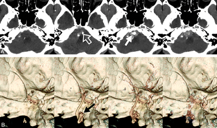 Fig 1.