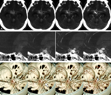 Fig 3.