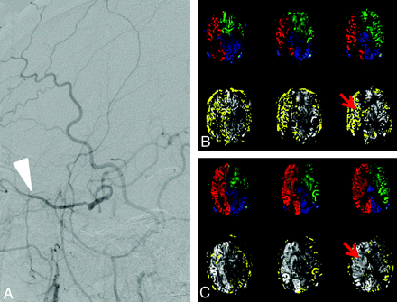 Fig 4.