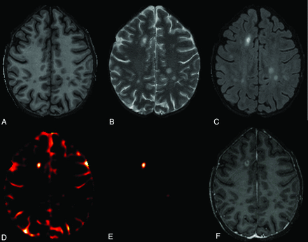 Fig 1.