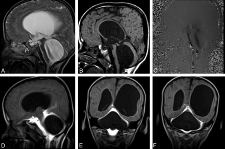 Fig 6.