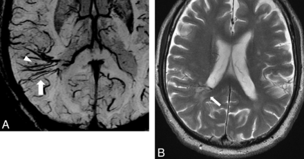 Fig 3.