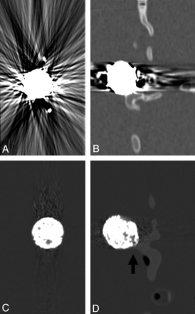 Fig 4.