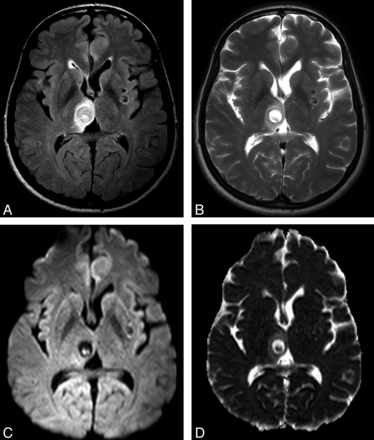 Fig 2.