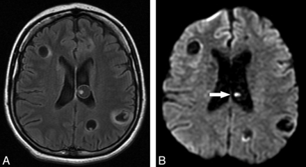 Fig 6.