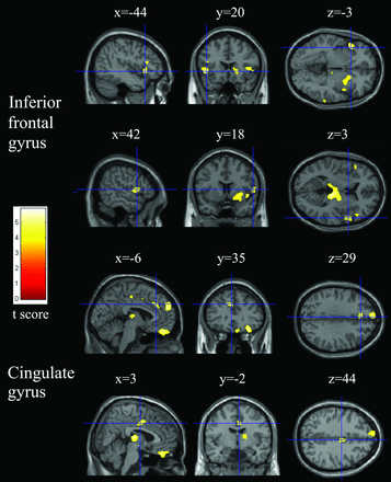 Fig 3.