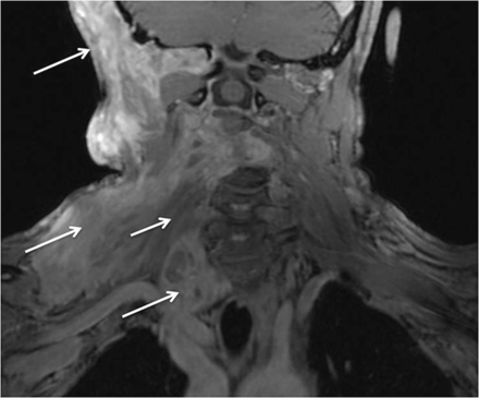 Fig. 14.