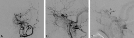 Fig. 9.