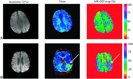 Fig 3.