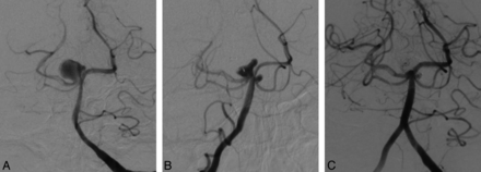 Fig 3.