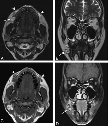 Fig 9.