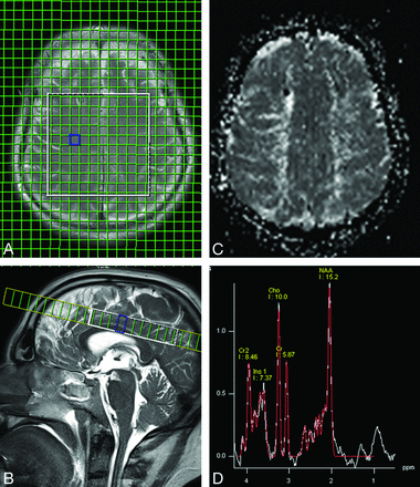 Fig 1.