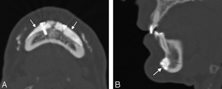 Fig 10.