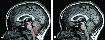 Fig 6.