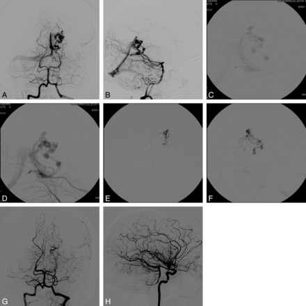 Fig 3.